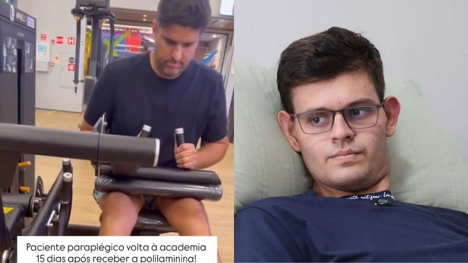 Saiba como se cadastrar para tratamento com polilaminina, ainda em fase de testes